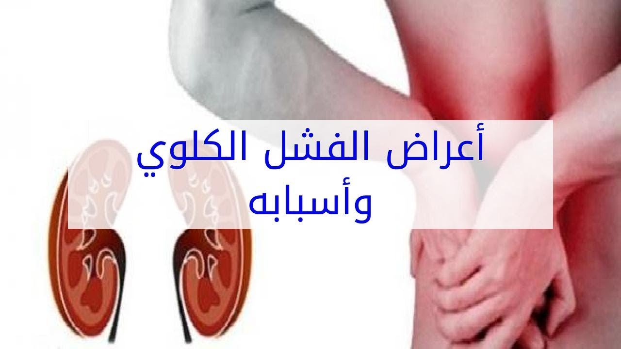 اعراض فشل الكلوي - الفشل الكلوى ومتى يظهر عليك 286 1