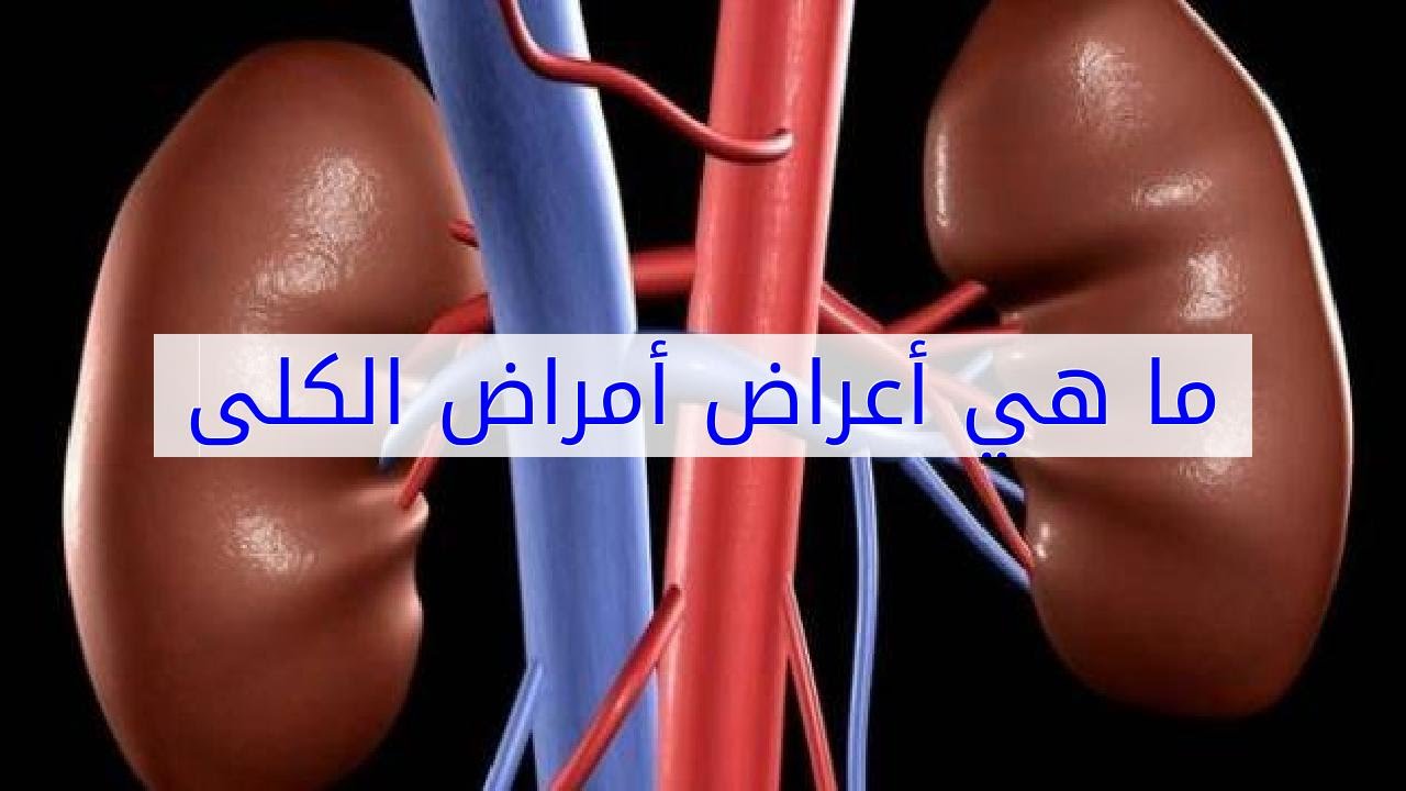 علامات مرض الكلى , تعرف علي اعراض مرض الكلي