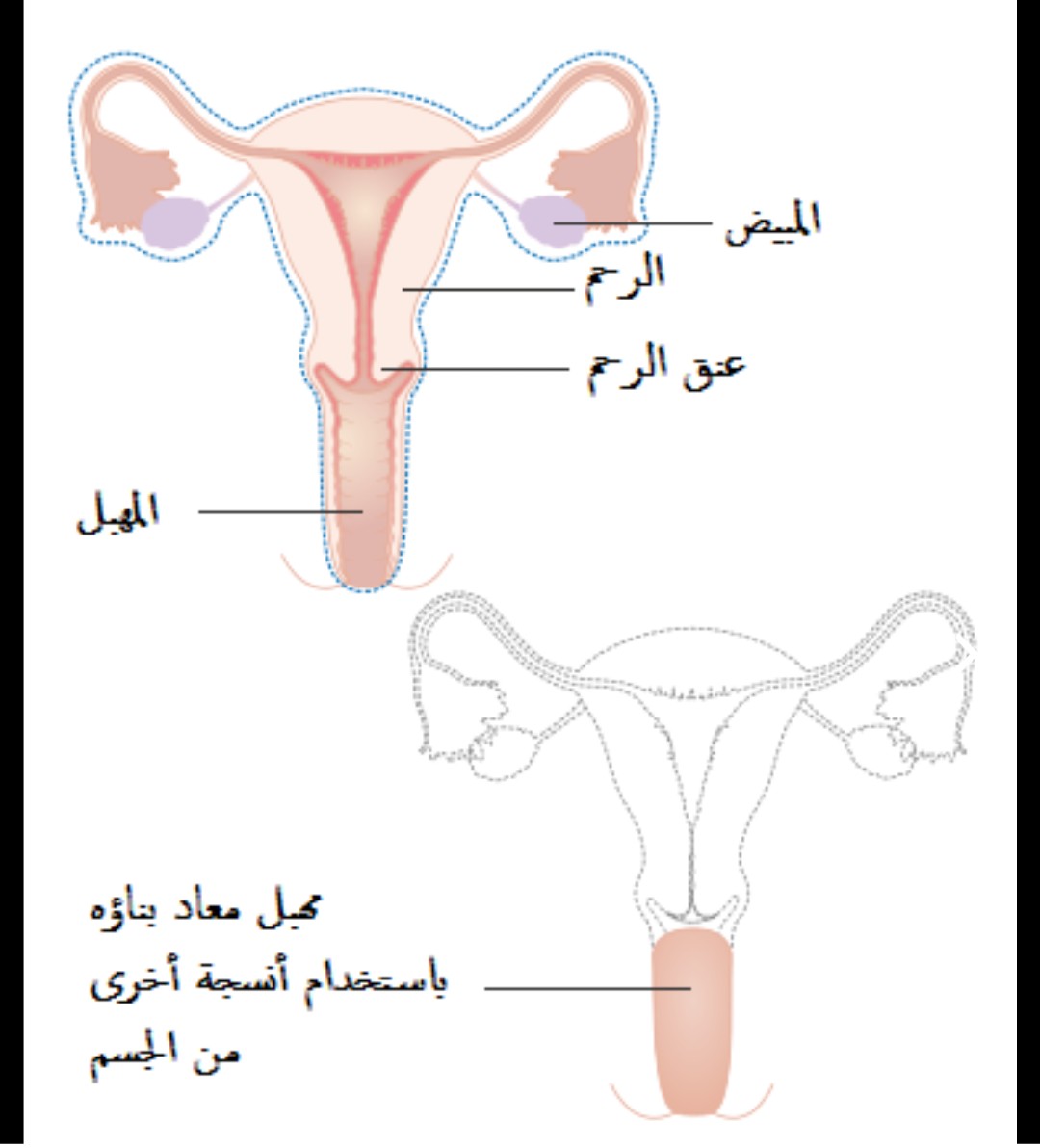 شكل فتحة المهبل , تعدد اشكال المهبل