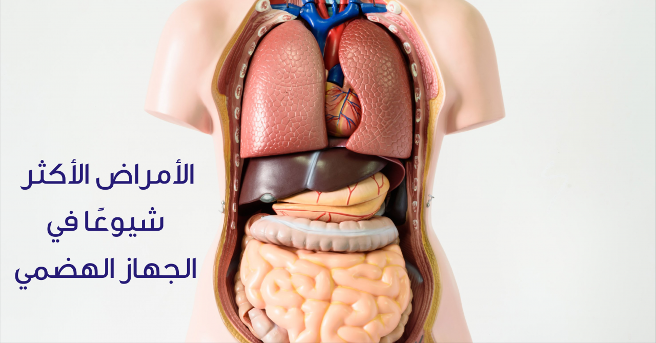 الامراض التي تصيب الجهاز الهضمي - علاج الام البطن 2169