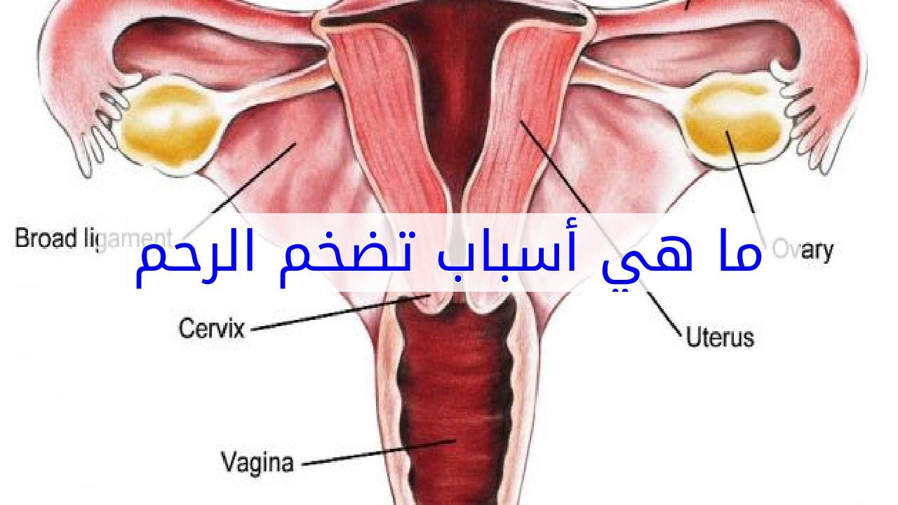 تضخم الرحم هل يمنع الحمل , الاسباب التي تؤدي الى حدوث تضخم في الرحم