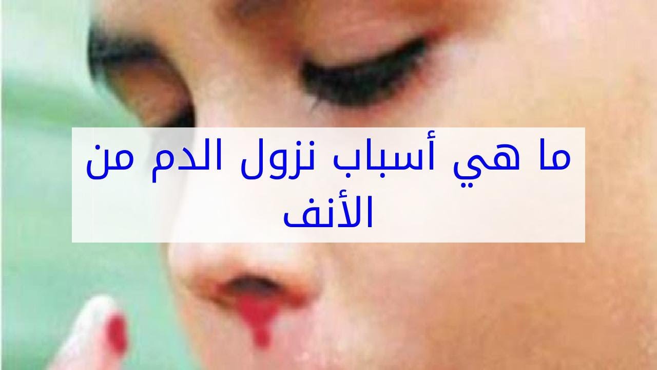 اسباب نزول الدم من الانف عند الاطفال - اشياء خاطئه لابد من تجنبها تفاديا لنزيف الانف 341 2