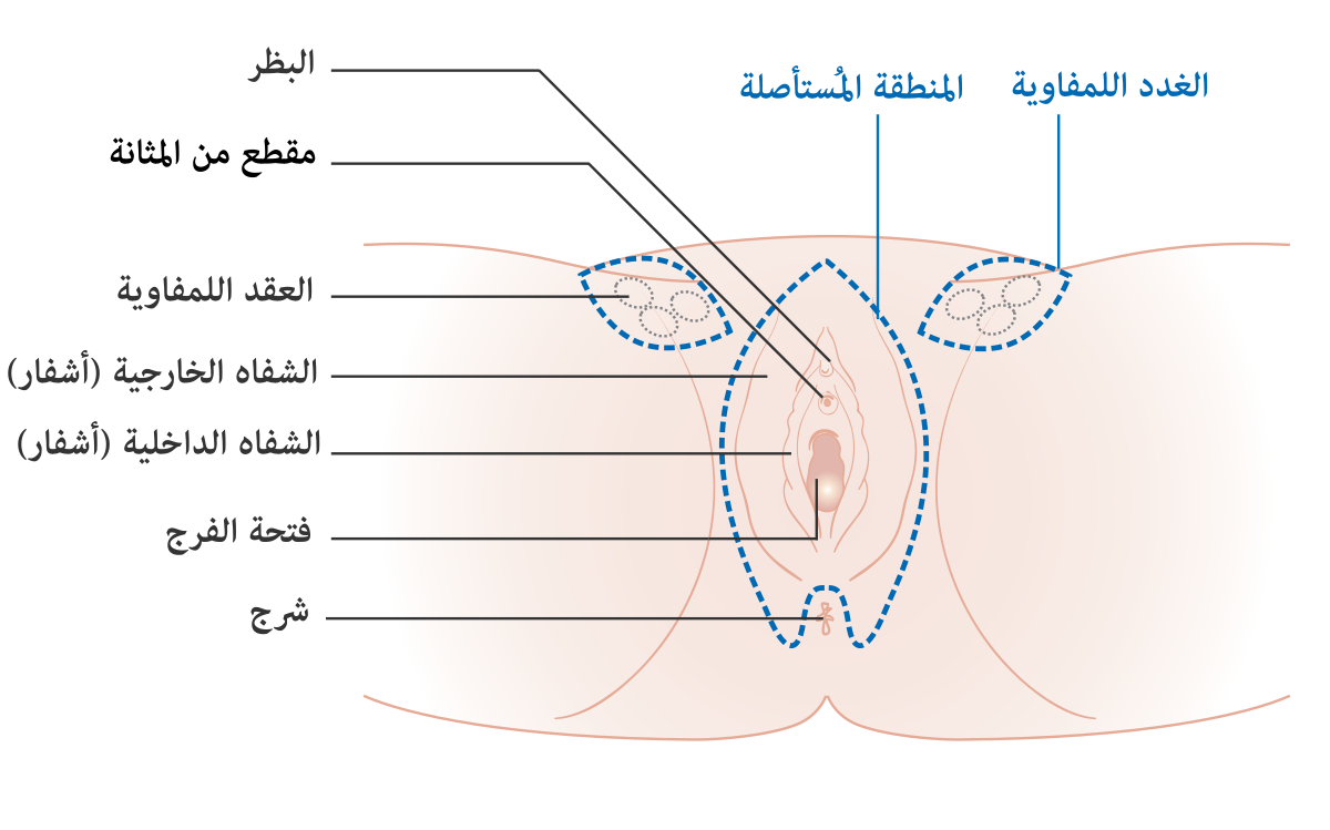 شكل فتحة المهبل - تعدد اشكال المهبل 3398