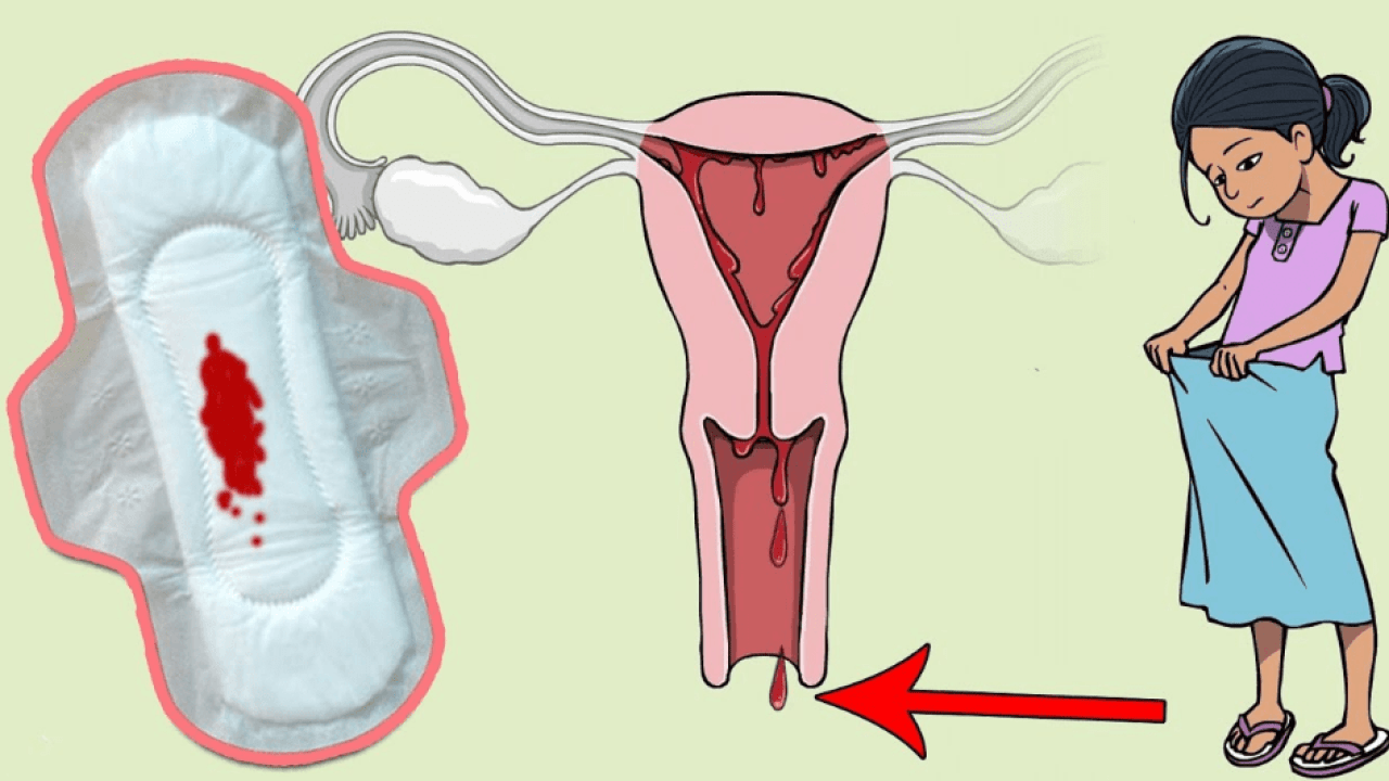 نزول دم بعد الدورة بعشرة ايام - تعرفى على اسباب نزول دماء مرة اخرى 3918 2