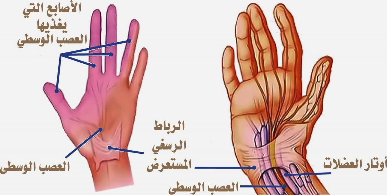 اعراض التهاب الاعصاب - الاعراض التي تبين وجود التهابات في الاعصاب 624 1