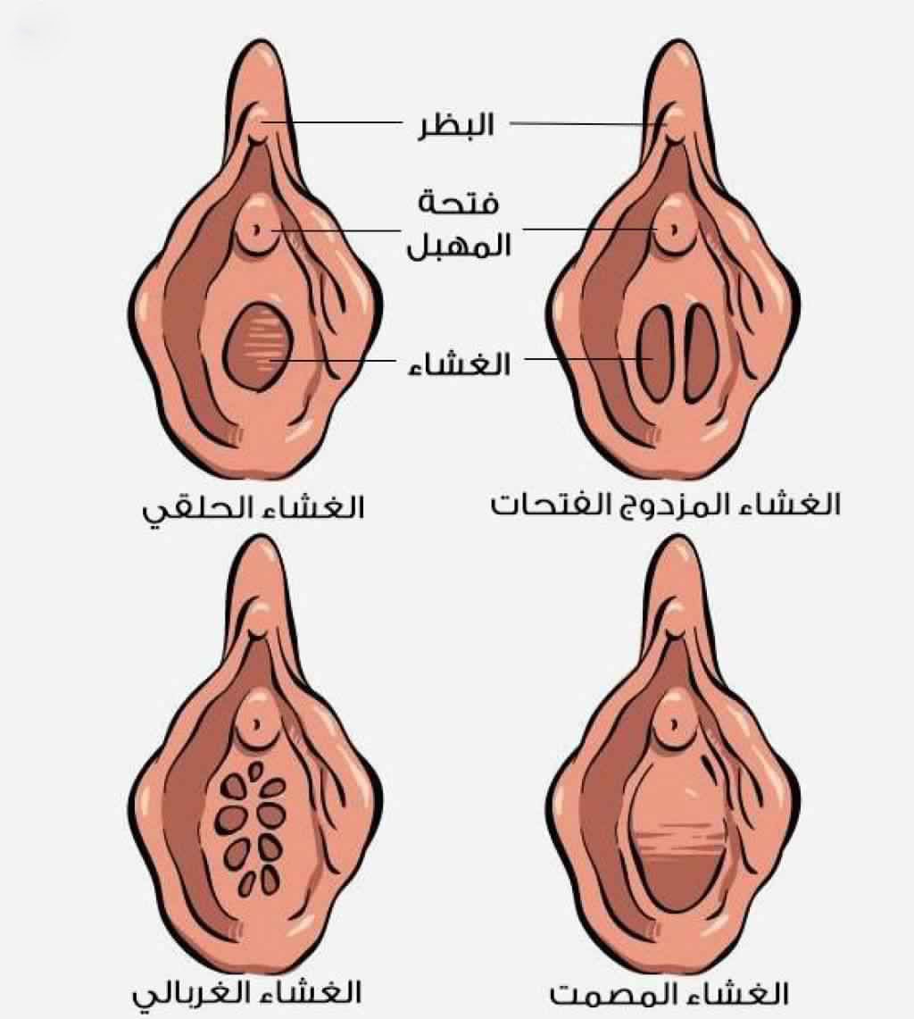 شكل فتحة المهبل - تعدد اشكال المهبل 3398 2