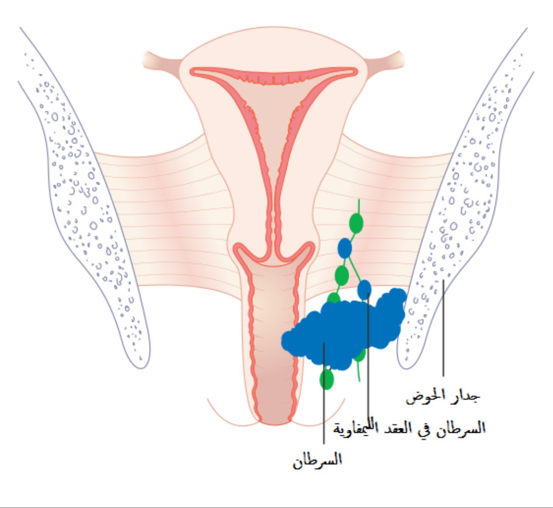 شكل فتحة المهبل - تعدد اشكال المهبل 3398