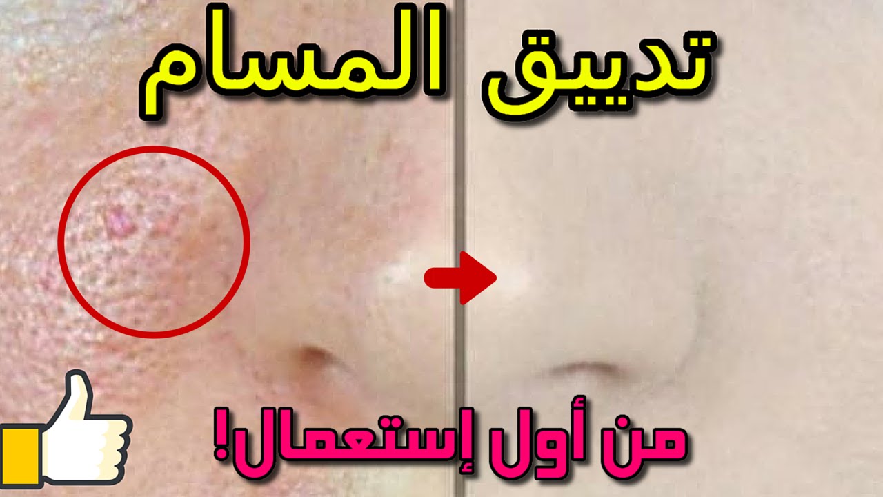 وصفة لغلق مسامات الوجه , طرق بسيطه تخلصك من مسامات الوجه